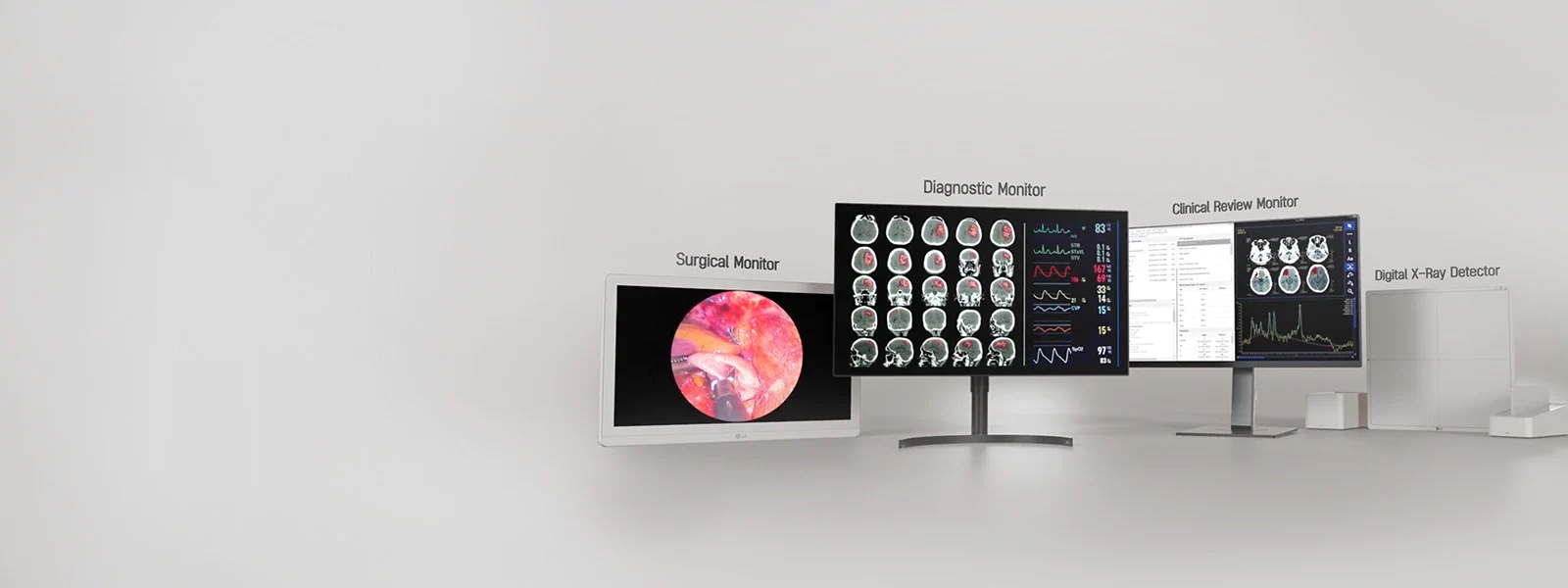 LG desarrolla software detector de rayos X digital con inteligencia artificial